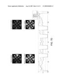 Systems and Methods for Correction of Inhomogeneities in Magnetic Resonance Images diagram and image