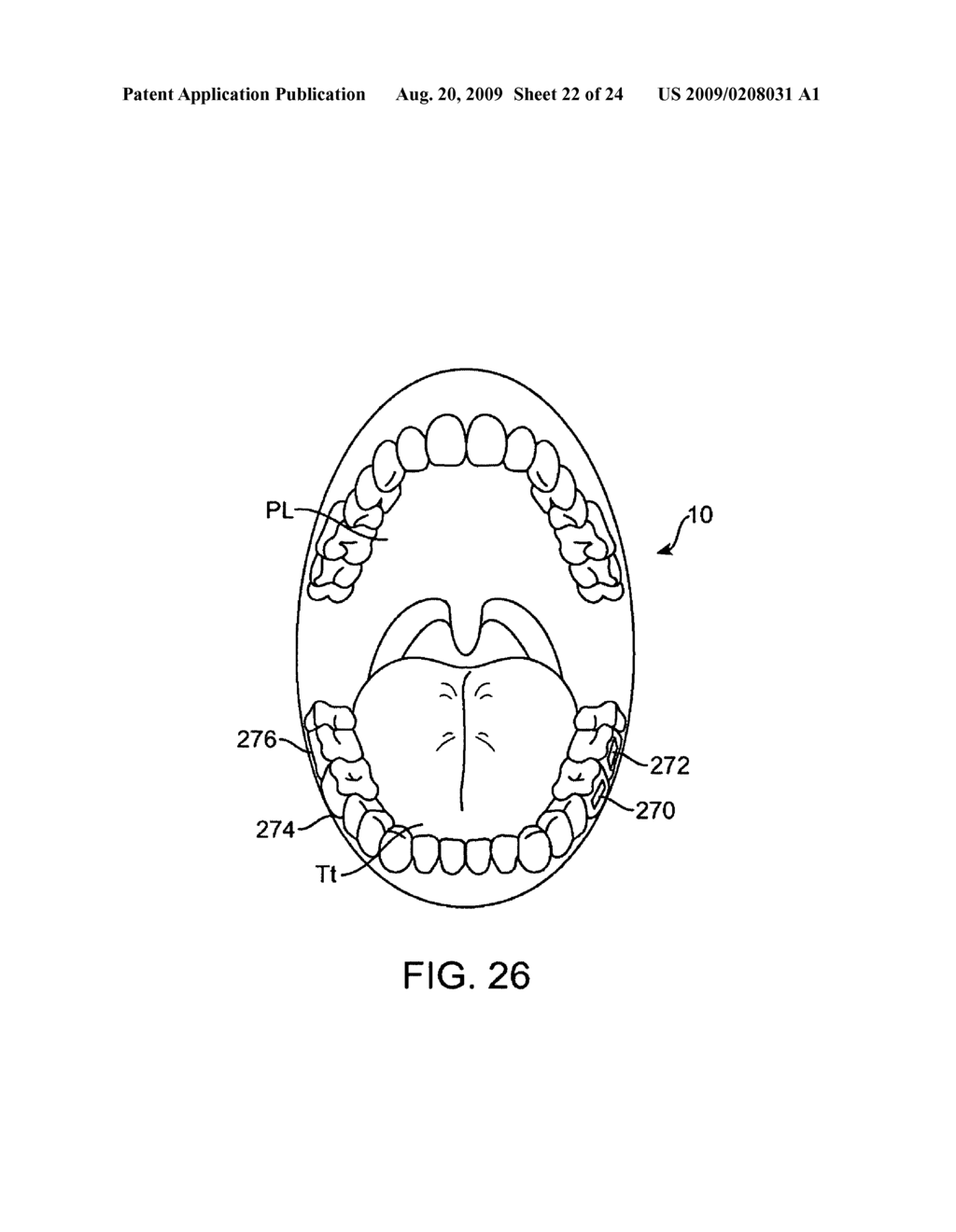 HEADSET SYSTEMS AND METHODS - diagram, schematic, and image 23