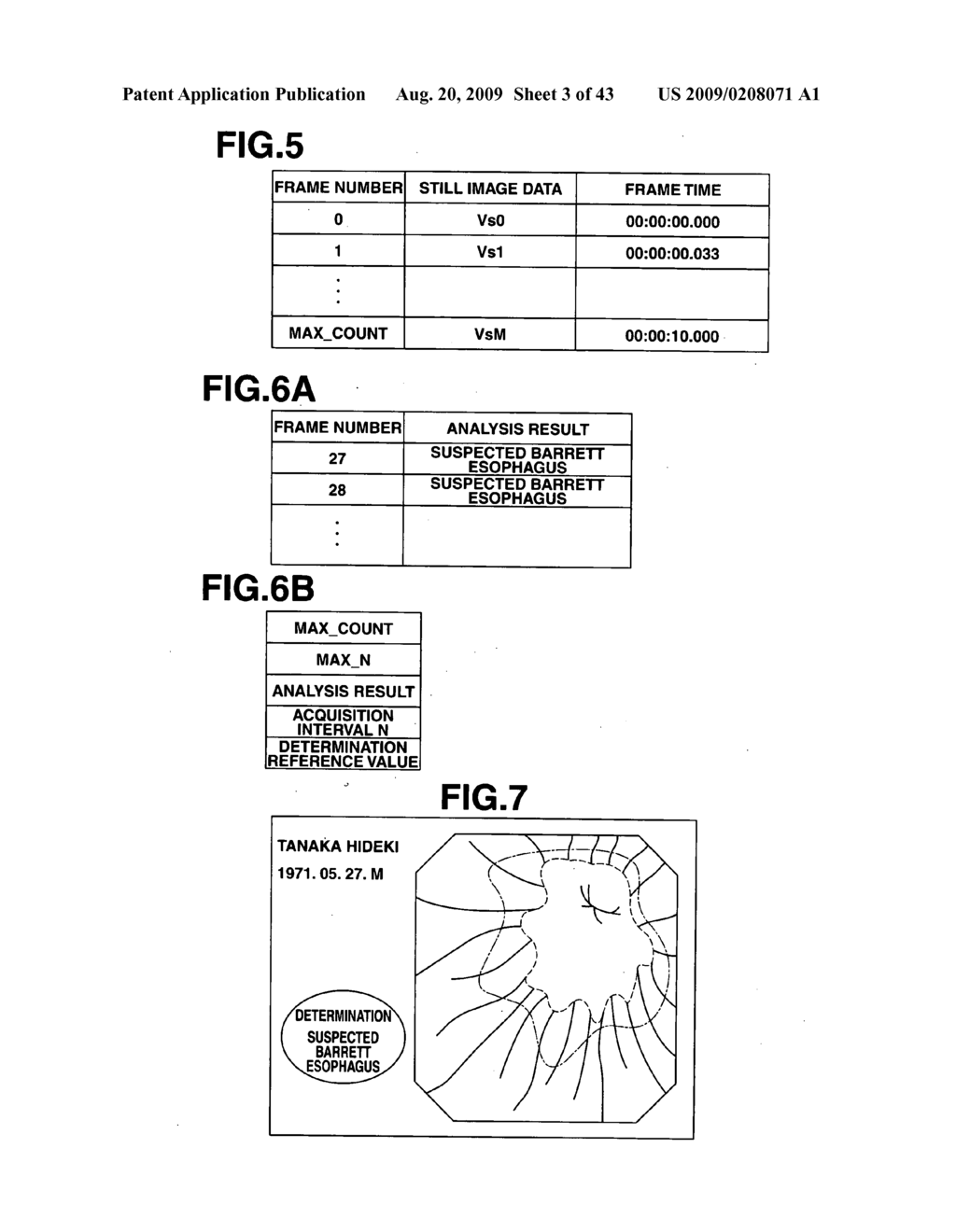 Medical Image Processing Apparatus, Luminal Image Processing Apparatus, Luminal Image Processing Method, and Programs for the Same - diagram, schematic, and image 04