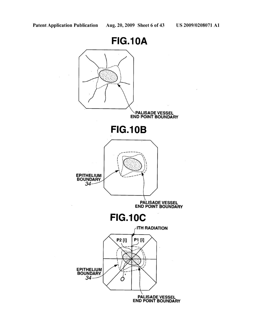 Medical Image Processing Apparatus, Luminal Image Processing Apparatus, Luminal Image Processing Method, and Programs for the Same - diagram, schematic, and image 07