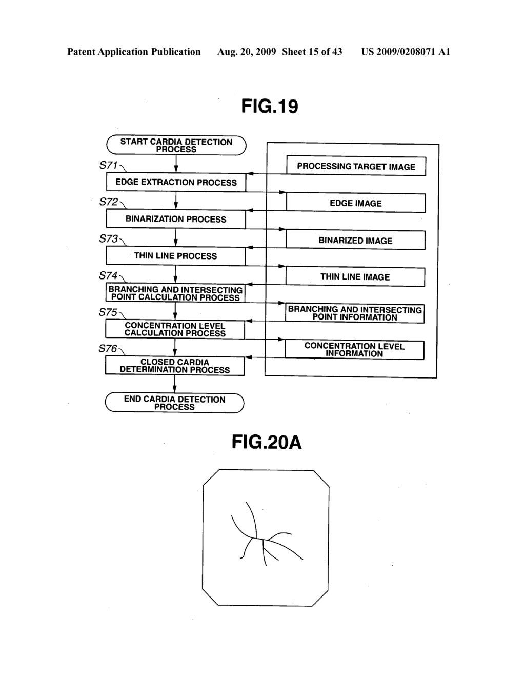 Medical Image Processing Apparatus, Luminal Image Processing Apparatus, Luminal Image Processing Method, and Programs for the Same - diagram, schematic, and image 16