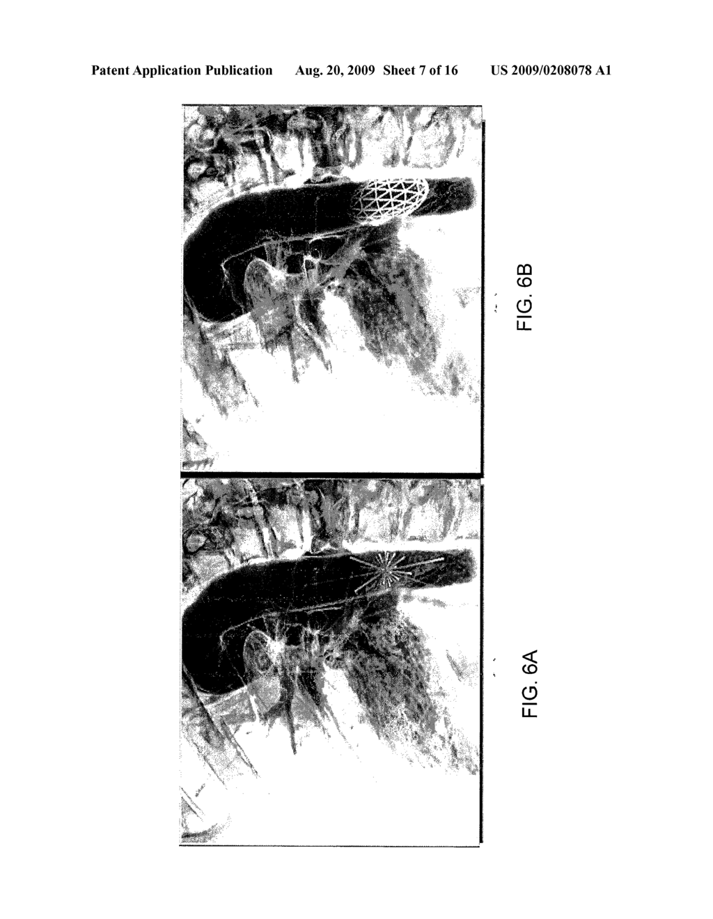 METHOD AND SYSTEM FOR AUTOMATIC DETERMINATION OF CORONORY SUPPLY REGIONS - diagram, schematic, and image 08