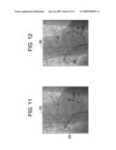 METHOD FOR GENERATING A REGISTERED IMAGE RELATIVE TO A CARDIAC CYCLE AND A RESPIRATORY CYCLE OF A PERSON diagram and image