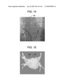 METHOD FOR GENERATING A REGISTERED IMAGE RELATIVE TO A CARDIAC CYCLE AND A RESPIRATORY CYCLE OF A PERSON diagram and image