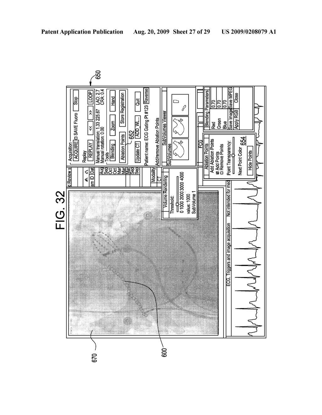 METHOD FOR GENERATING A REGISTERED IMAGE RELATIVE TO A CARDIAC CYCLE AND A RESPIRATORY CYCLE OF A PERSON - diagram, schematic, and image 28