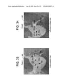 METHOD FOR GENERATING A REGISTERED IMAGE RELATIVE TO A CARDIAC CYCLE AND A RESPIRATORY CYCLE OF A PERSON diagram and image