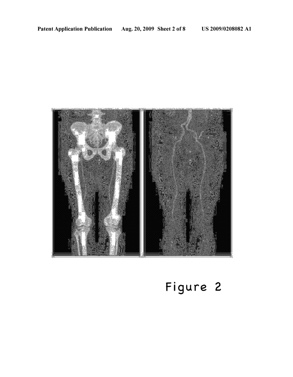 AUTOMATIC IMAGE SEGMENTATION METHODS AND APPARATUS - diagram, schematic, and image 03