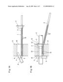 Anchoring device diagram and image