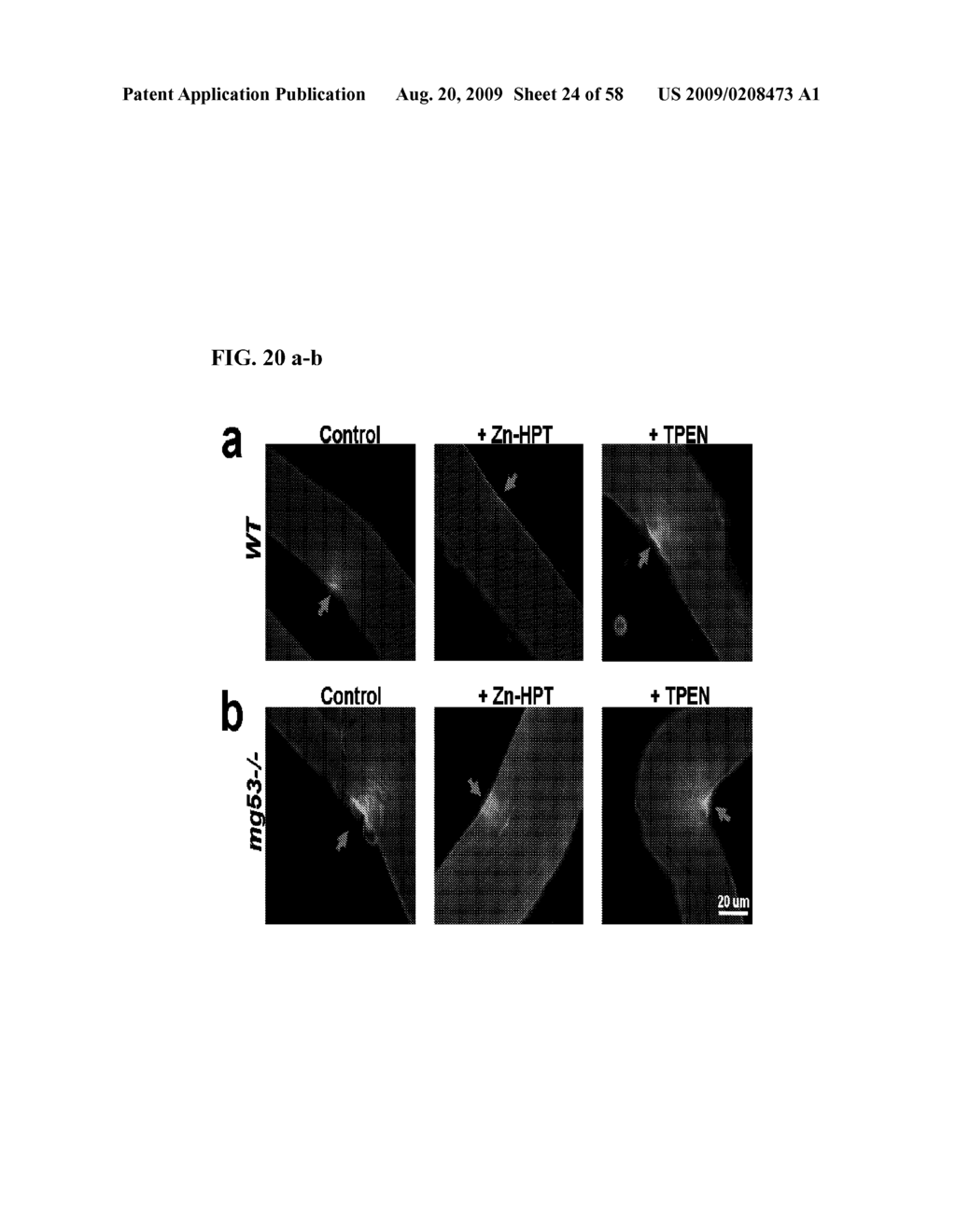 COMPOSITIONS AND METHODS TO MODULATE CELL MEMBRANE RESEALING - diagram, schematic, and image 25