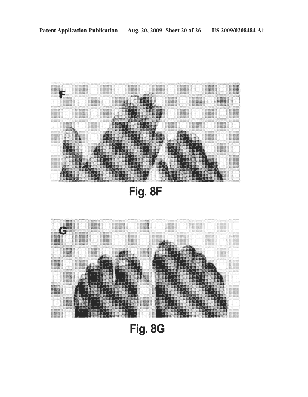 R-SPONDIN COMPOSITIONS AND METHODS OF USE THEREOF - diagram, schematic, and image 21