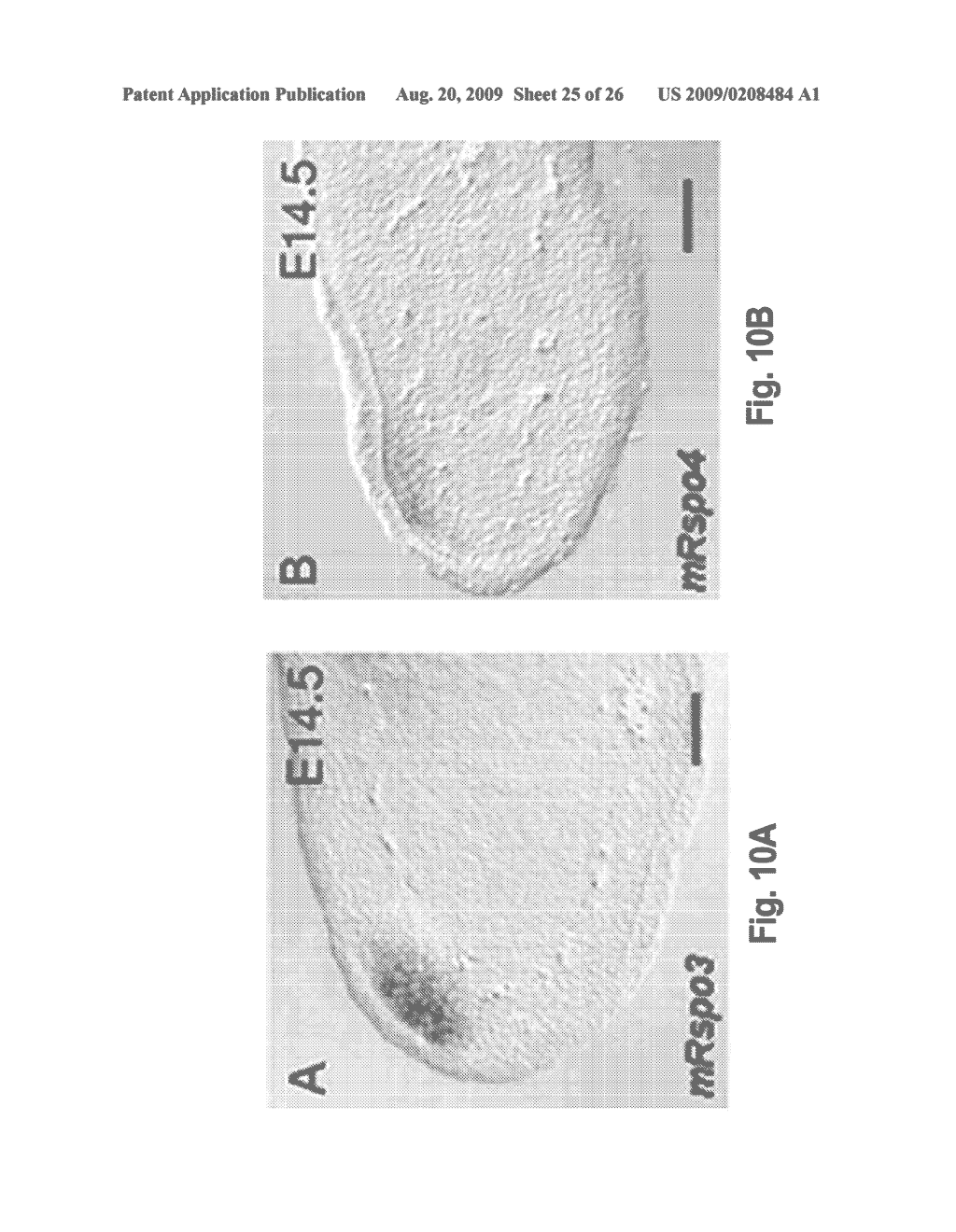 R-SPONDIN COMPOSITIONS AND METHODS OF USE THEREOF - diagram, schematic, and image 26