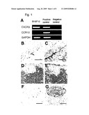 Pharmaceutical composition comprising cxcr3 inhibitor diagram and image