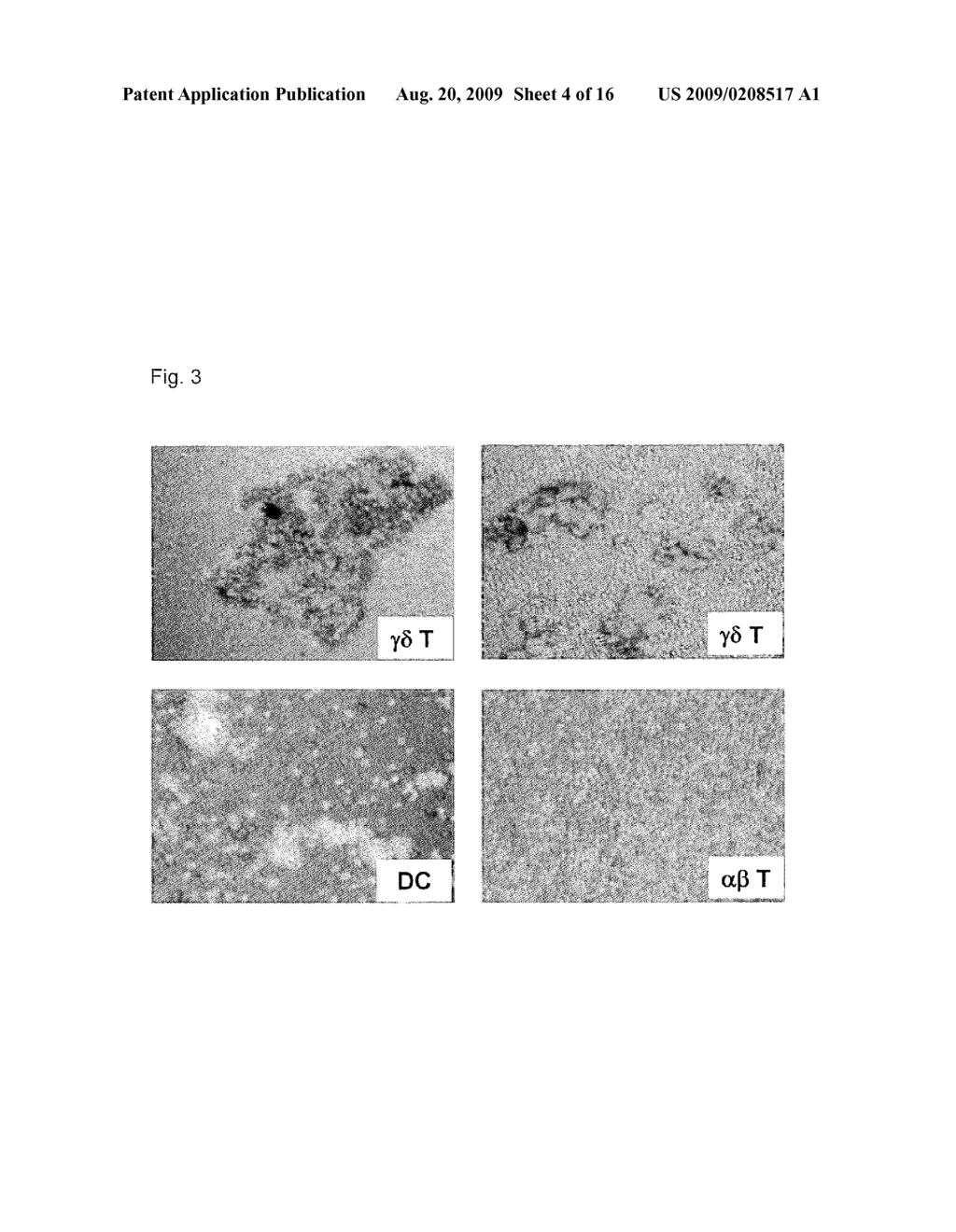 Preparation Of Antigen-Presenting Human Gamma-Delta T Cells And Use In Immunotherapy - diagram, schematic, and image 05