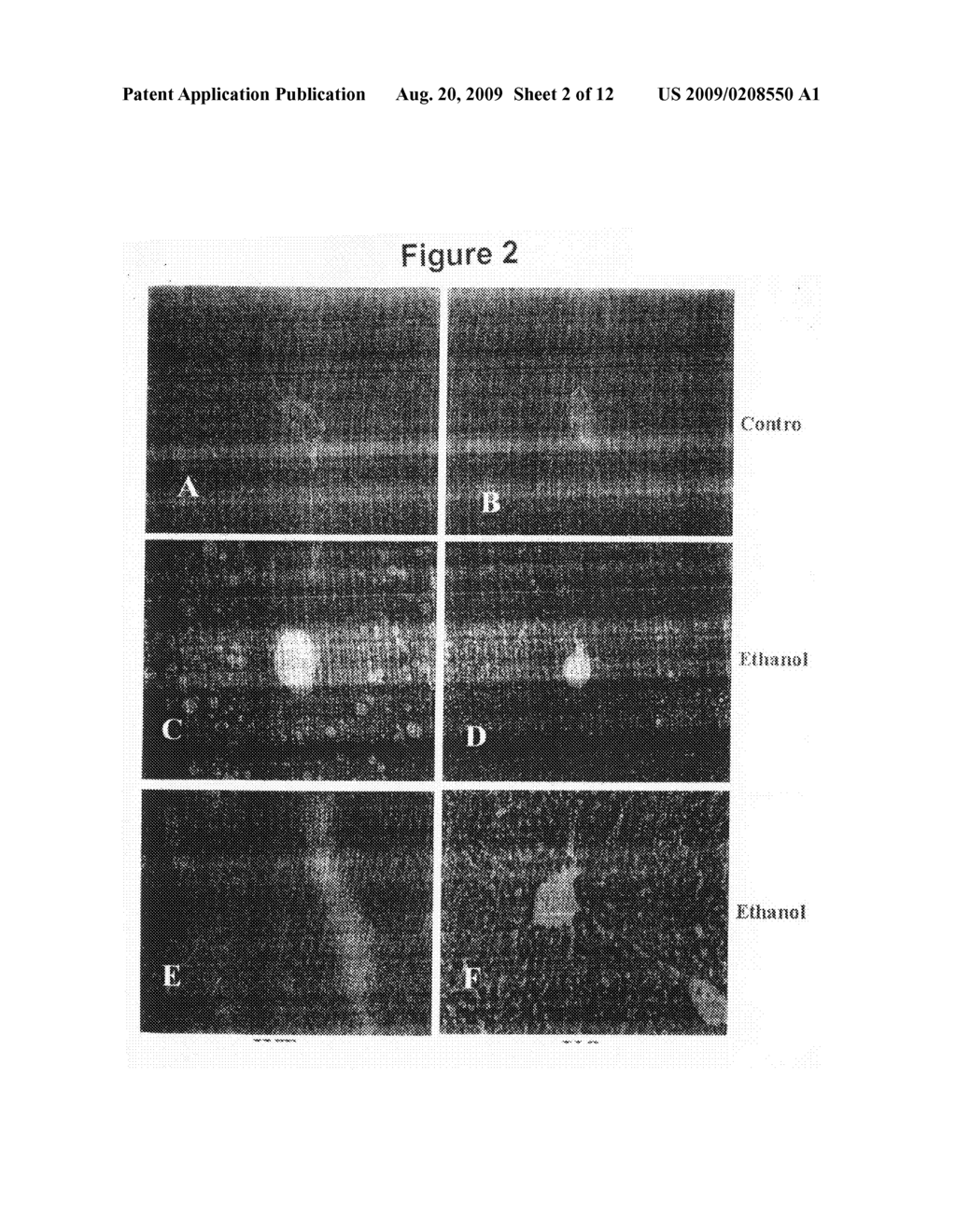 Methods and compositions for treating hepatic diseases - diagram, schematic, and image 03