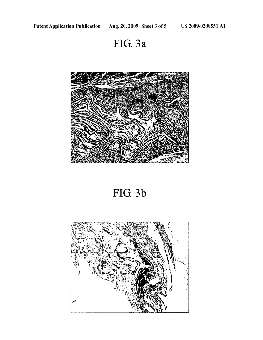 Biological implantation material and method for preparing same - diagram, schematic, and image 04