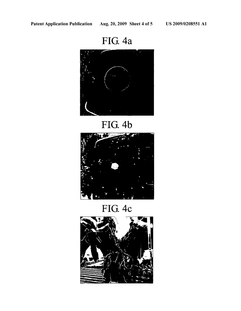 Biological implantation material and method for preparing same - diagram, schematic, and image 05