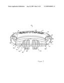 Dental implement for tooth restoration diagram and image