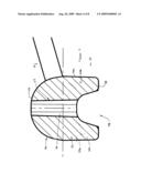 Dental implement for tooth restoration diagram and image