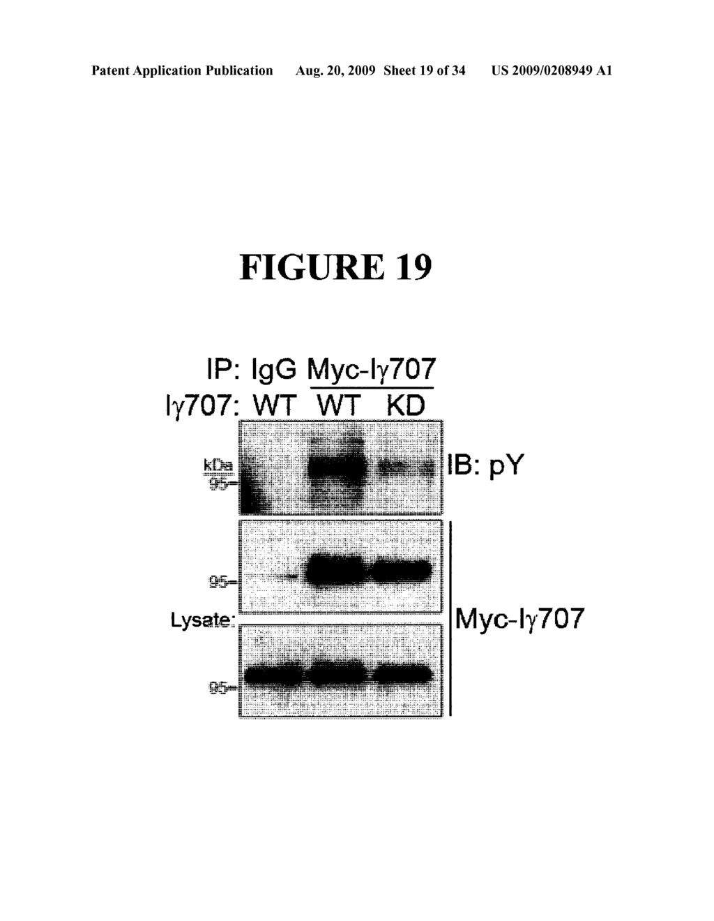 PHOSPHATIDYLINOSITOL PHOSPHATE KINASE TYPE I GAMMA SPLICE VARIANTS AS BIOMARKERS AND DRUG TARGETS FOR EPITHELIAL CANCERS - diagram, schematic, and image 20