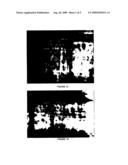 Non-Invasive in Vitro Method to Detect Transitional Cell Carcinoma of the Bladder diagram and image