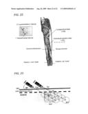 GENE DELIVERY FORMULATIONS AND METHODS FOR TREATMENT OF ISCHEMIC CONDITIONS diagram and image