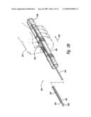 Apparatuses and methods for percutaneously implanting objects in patients diagram and image