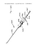 Apparatuses and methods for percutaneously implanting objects in patients diagram and image