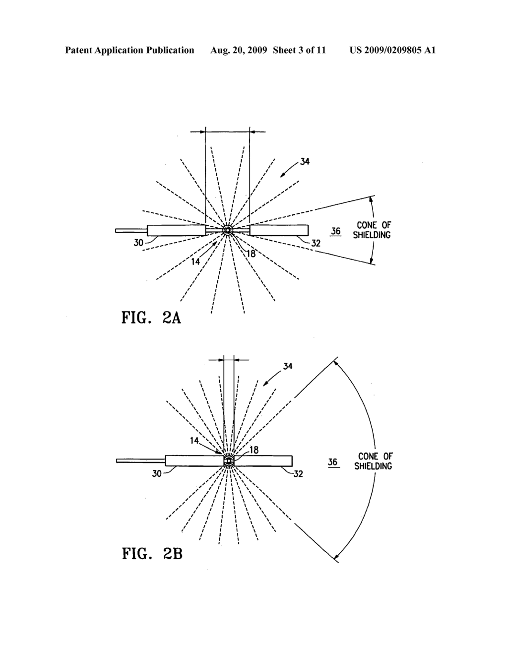 Tissue irradiation - diagram, schematic, and image 04