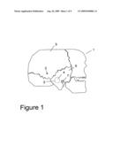 IMPLANTABLE TRANSDUCER diagram and image