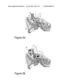 IMPLANTABLE TRANSDUCER diagram and image