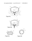 IMPLANTABLE TRANSDUCER diagram and image