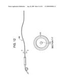 Intubation systems and methods diagram and image