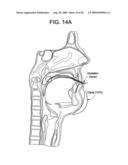 Intubation systems and methods diagram and image