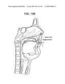 Intubation systems and methods diagram and image