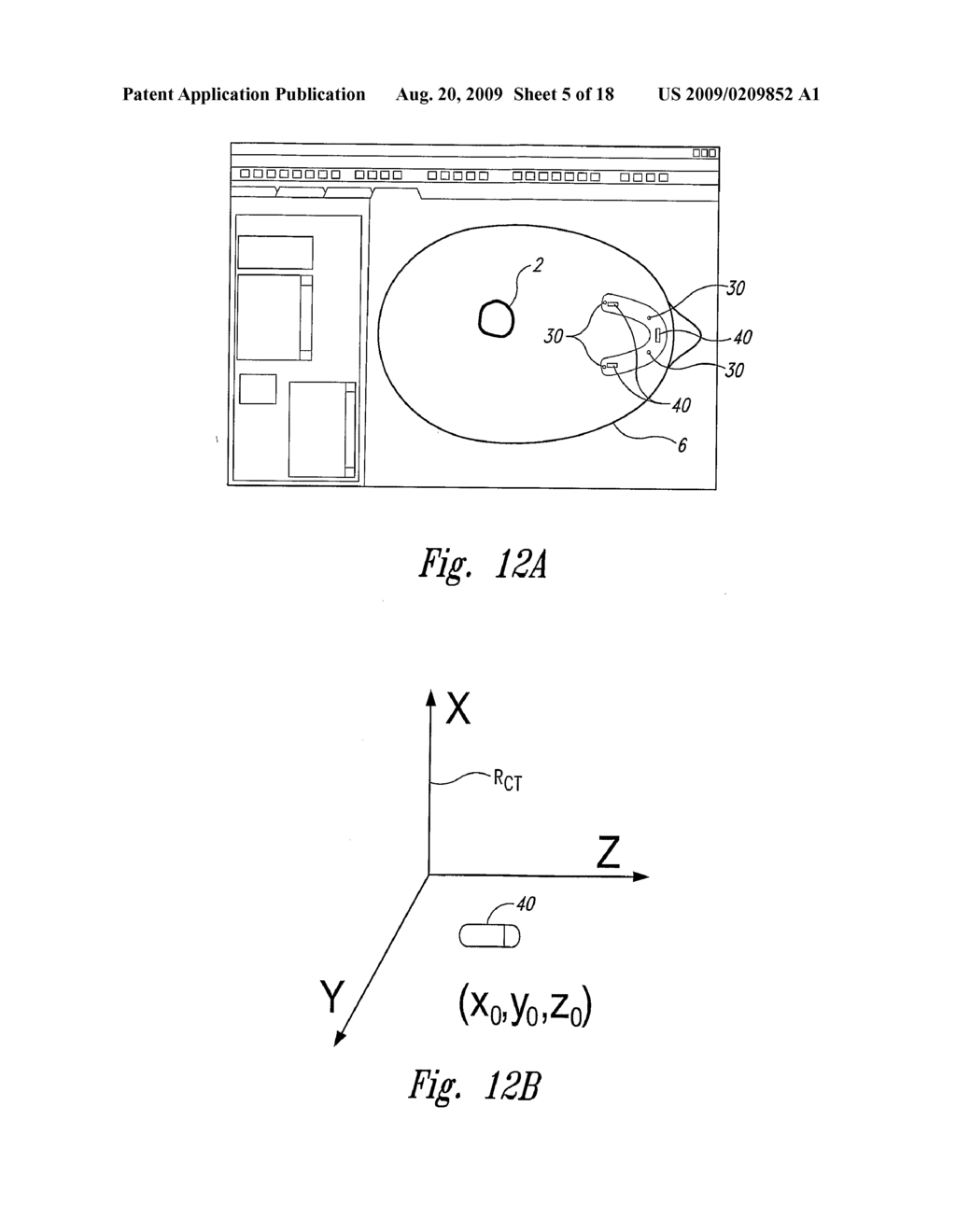 Systems and Methods for Treating a Patient Using Guided Radiation Therapy or Surgery - diagram, schematic, and image 06