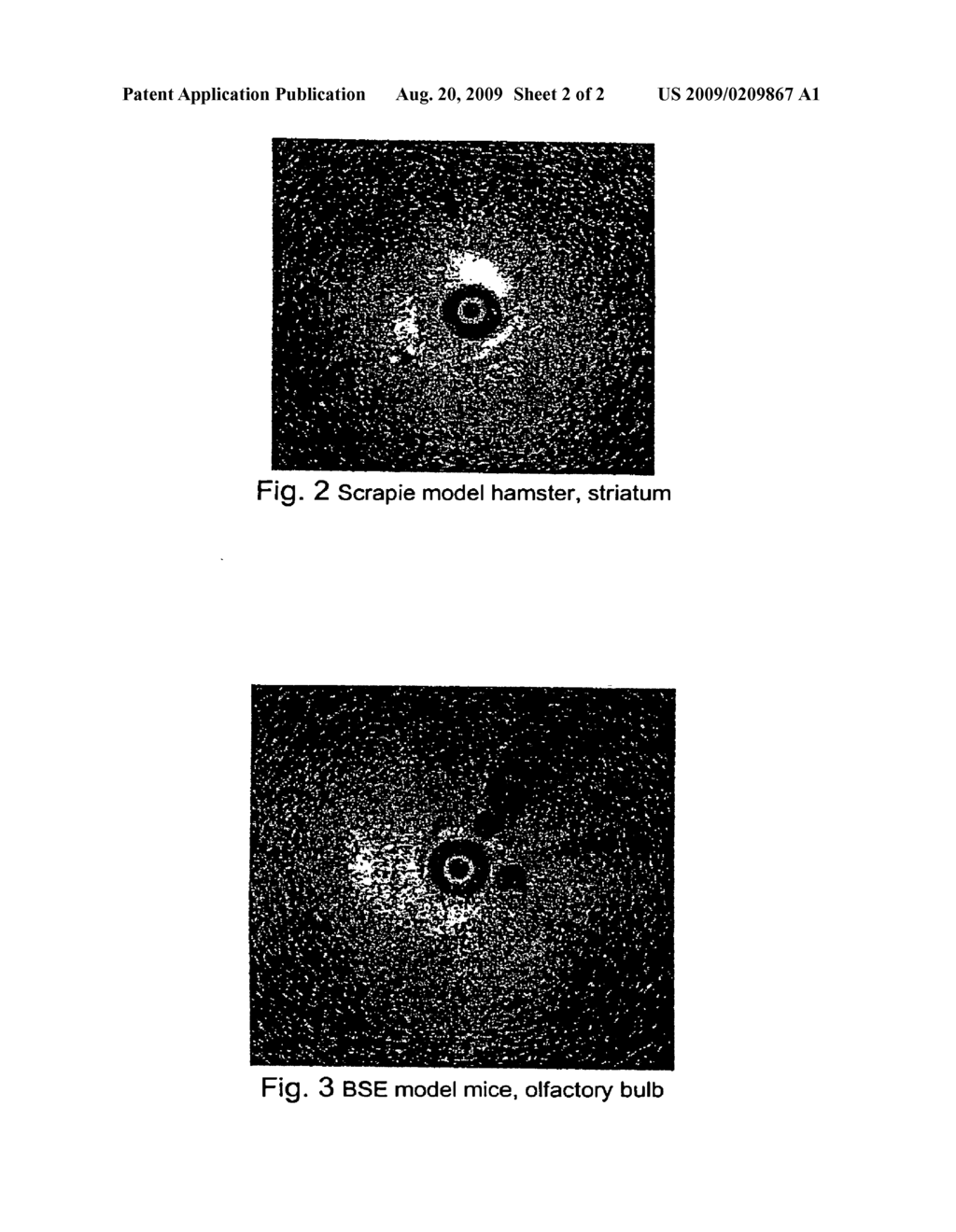 METHOD FOR RAPID SCREENING OF MAD COW DISEASE AND OTHER TRANSMISSIBLE SPONGIFORM ENCEPHALOPATHIES - diagram, schematic, and image 03