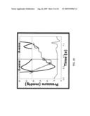 PRESSURE RECOVERY INDEX TO ASSESS CARDIAC FUNCTION diagram and image