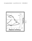 PRESSURE RECOVERY INDEX TO ASSESS CARDIAC FUNCTION diagram and image