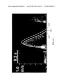 PRESSURE RECOVERY INDEX TO ASSESS CARDIAC FUNCTION diagram and image