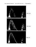 PRESSURE RECOVERY INDEX TO ASSESS CARDIAC FUNCTION diagram and image