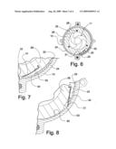 Trocar for thoracic surgery diagram and image