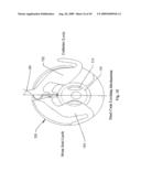 METHOD AND DEVICE FOR DIALYSIS diagram and image