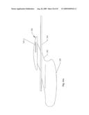 METHOD AND DEVICE FOR DIALYSIS diagram and image