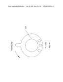 METHOD AND DEVICE FOR DIALYSIS diagram and image