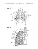 ASPIRATOR AND METHOD FOR PNEUMOSTOMA MANAGEMENT diagram and image