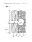 ASPIRATOR AND METHOD FOR PNEUMOSTOMA MANAGEMENT diagram and image