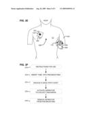 ASPIRATOR AND METHOD FOR PNEUMOSTOMA MANAGEMENT diagram and image