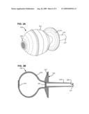 ASPIRATOR AND METHOD FOR PNEUMOSTOMA MANAGEMENT diagram and image