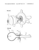 ASPIRATOR AND METHOD FOR PNEUMOSTOMA MANAGEMENT diagram and image