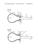 ASPIRATOR AND METHOD FOR PNEUMOSTOMA MANAGEMENT diagram and image